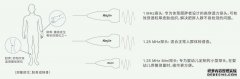 三探头超声骨密度仪KJ7000A+